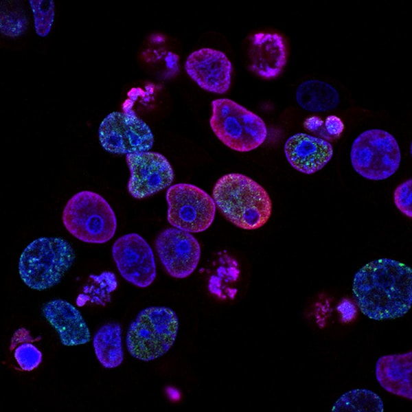 Biofilm bacteria